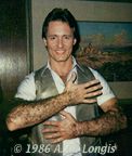 Anthony shows off his hairy arms
